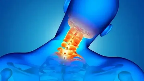 Boyun fıtığının asıl tetikçisi ortaya çıktı: Günlük alışkanlığımız meğer sır perdesini aralamış!
