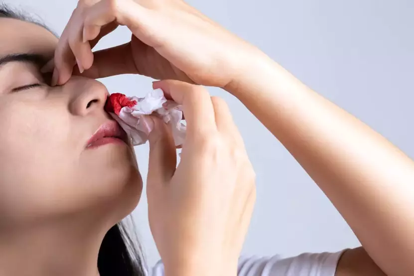 Burun Kanaması: Sırasında Yapılan En Sık Hata ve Nasıl Önlenir?