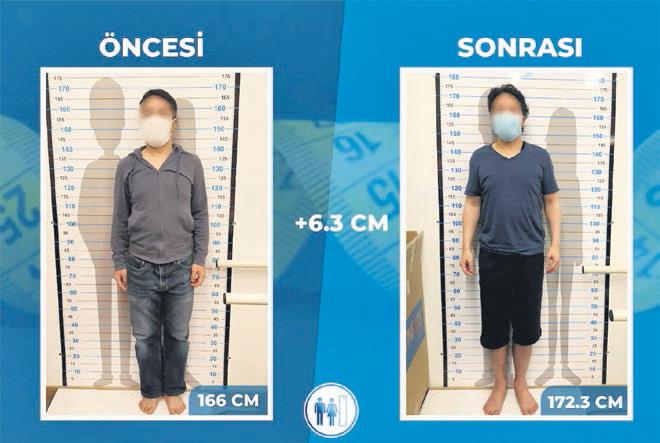 İngiliz Erkekler Boy Uzatma Amacıyla Türkiye’ye Akın Ediyor