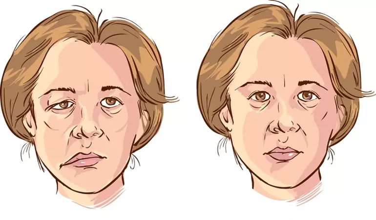 Vaka Sayısı Süratle Artıyor: Doktorlar da Hayatlarını Yitiriyor! ‘12 Saatlik Hızla İleri Evre’, ‘Korkudan Annem Aynaları Kaldırdı’ | Bu Belirtilere Dikkat!