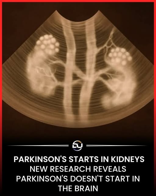 Parkinson’un Kaynağı Beyin Değil Böbrek mi? Wuhan Üniversitesi’nden Çığır Açan Araştırma
