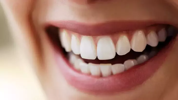 Rüyada İnsan Dişi Görmenin Yorumu ve Anlamı