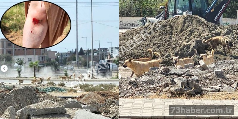 Silopi'de Sahipsiz Köpek Terörü: Bir Kadın Yaralı
