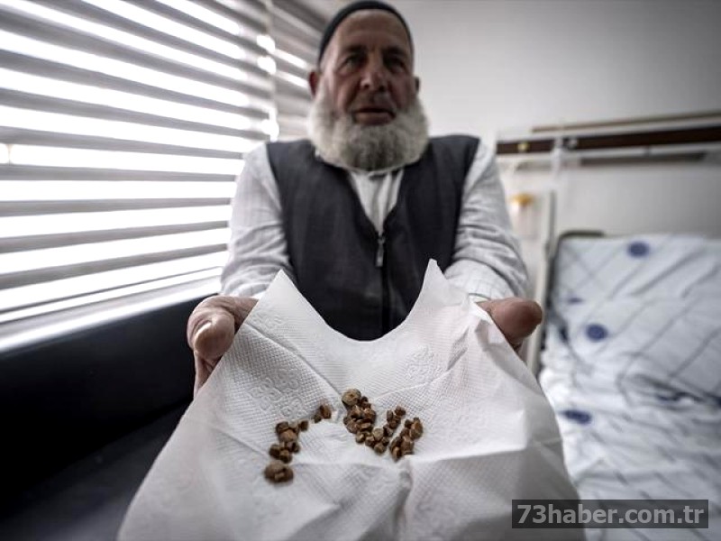 İnanılmaz Vücut Buluntuları